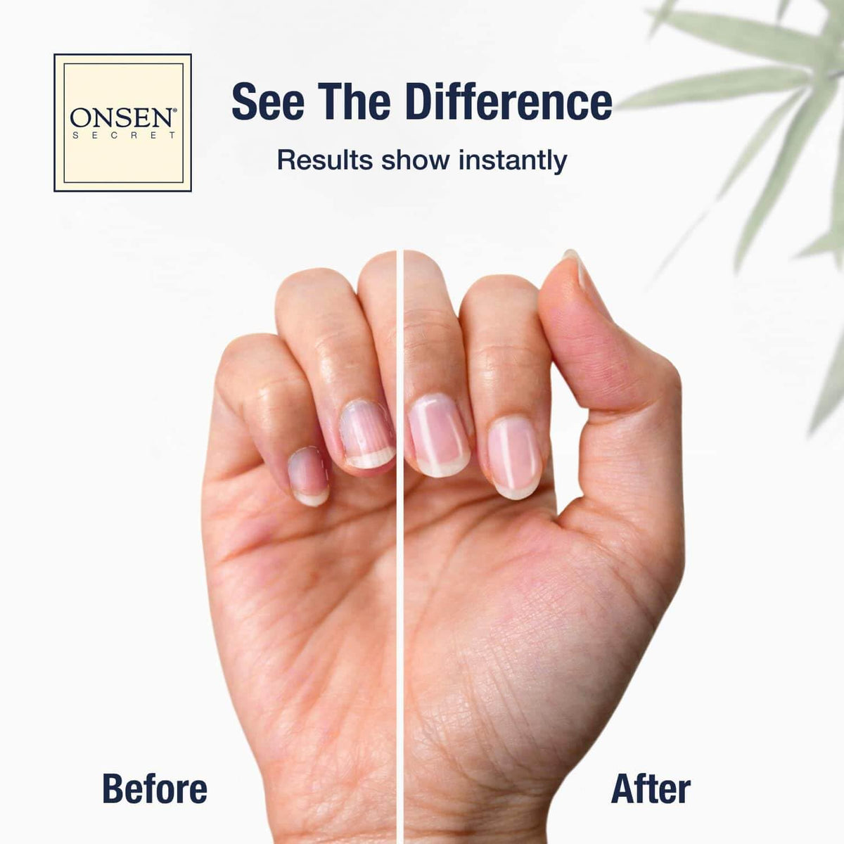 Onsen Secret Japanese Nail Care Kit - Cuticle Oil Serum | Nail Buffer and Shine Kit - Strengthening & Shining - Spa-Quality Manicure w/Organic Ingredients - Long-Lasting Shine - Easy & Safe, 1pk
