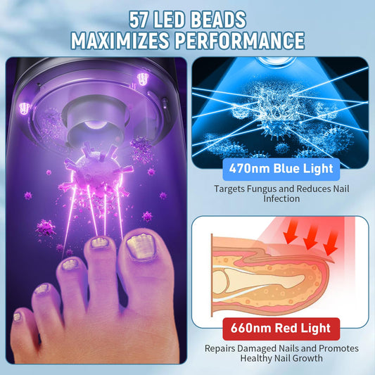 iKeener Nail Fungus Laser Device for Multiple Toenail, FDA Cleared Anti-Fungal Nail Treatment with 15 * 470nm Blue Light & 42 * 650nm Red Light, 3/5/7/10 Minutes Adjustable