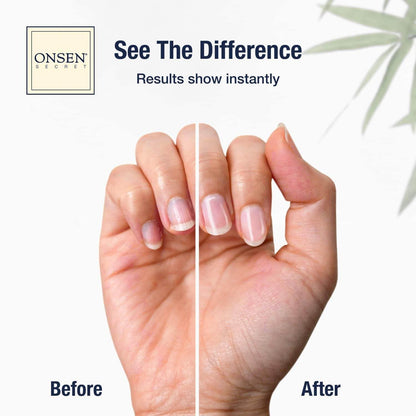 Onsen Secret Japanese Nail Care Kit - Cuticle Oil Serum | Nail Buffer and Shine Kit - Strengthening & Shining - Spa-Quality Manicure w/Organic Ingredients - Long-Lasting Shine - Easy & Safe, 1pk