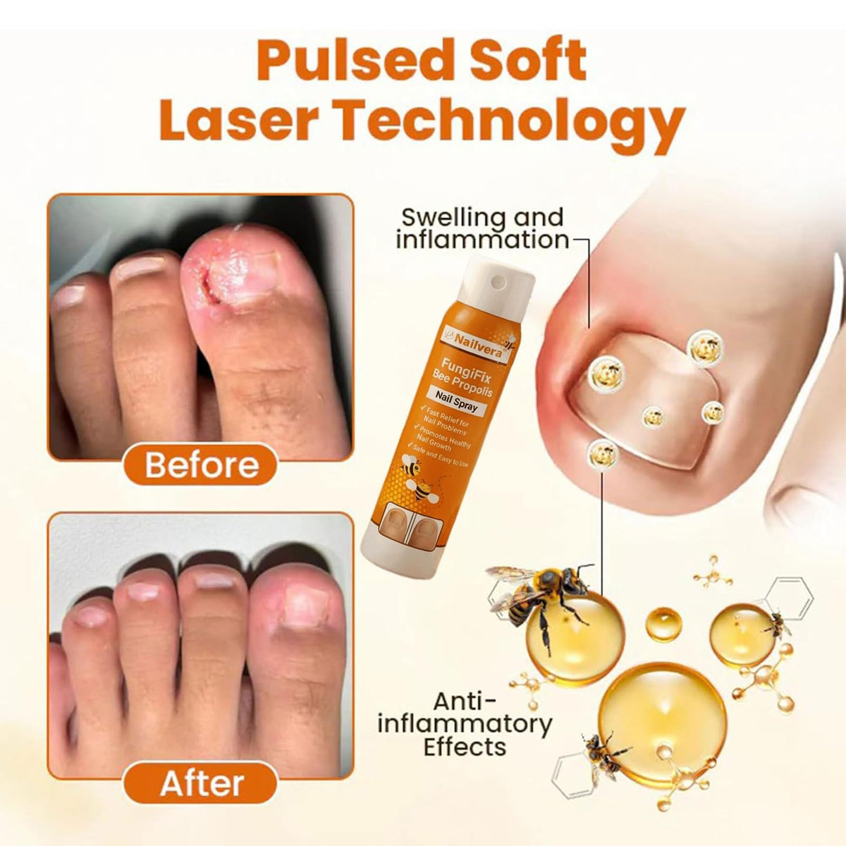 Nailvera Nail Fungal Treatment Spray, 2026 Best Nailvera Fungifix Bee Propolis & Bee Venom Nail Repair Spray, Antifungal Nail Fungus Treatment, Clear Nail Treatment for Toenail and Fingernail (2 Pcs)
