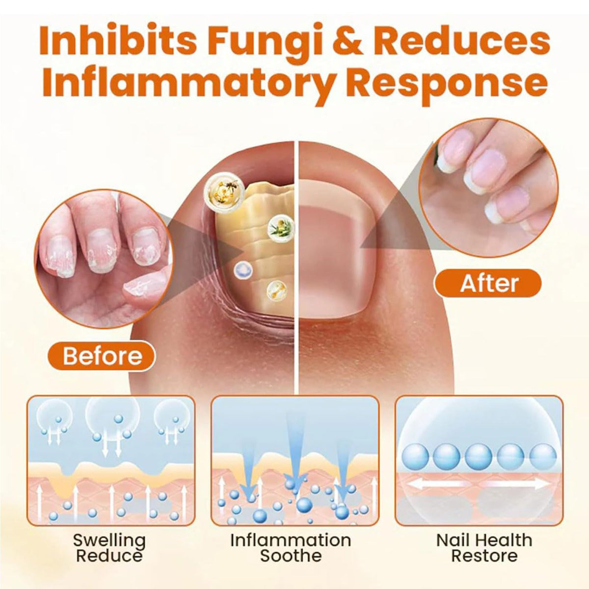Nailvera Nail Fungal Treatment Spray, 2026 Best Nailvera Fungifix Bee Propolis & Bee Venom Nail Repair Spray, Antifungal Nail Fungus Treatment, Clear Nail Treatment for Toenail and Fingernail (2 Pcs)