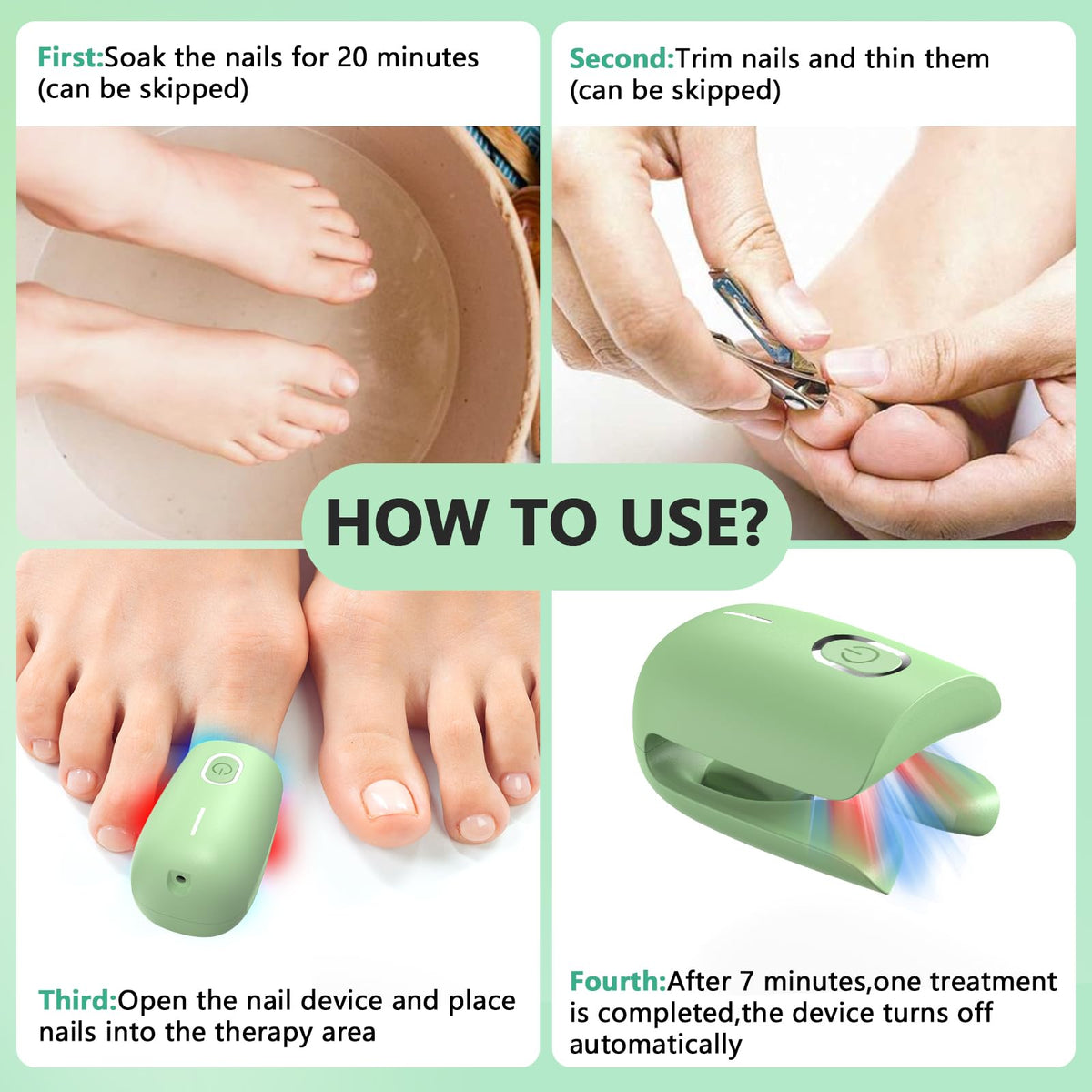 iKeener Nail Fungus Laser Treatment Device,Nail Laser Cleaning for Toenail Fingernails & Onychomycosis,Home Use Nail-Fungus Remover by 470nm Blue Light+660nm Red Light+905nm Infrared Light (Green)